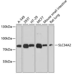 SLC34A2 Antibody - Azide and BSA Free, Novus Biologicals:Anticorps:Anticorps