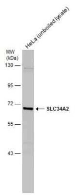 SLC34A2 Antibody, Novus Biologicals 100 &mu;g | Buy Online | Novus Biologicals | Fisher Scientific