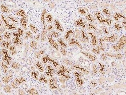 SLC34A3 Antibody, Novus Biologicals 50 &mu;g; Unconjugated:Antibodies,