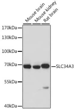 SLC34A3 Antibody - Azide and BSA Free, Novus Biologicals:Antibodies:Primary