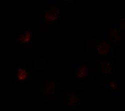 SLC35D3 Antibody - BSA Free, Novus Biologicals 0.1 mg; Unconjugated:Antibodies,