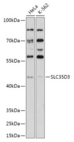 SLC35D3 Antibody - Azide and BSA Free, Novus Biologicals 0.02 mL; Unconjugated:Antibodies,