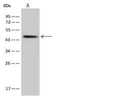 SLC35E1 Antibody, Novus Biologicals 100 &mu;g | Buy Online | Novus Biologicals | Fisher Scientific