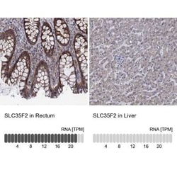SLC35F2 Rabbit anti-Human, Polyclonal, Novus Biologicals 100 &mu;g; Unconjugated:Antibodies,