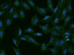 SLC35G2 Antibody, Novus Biologicals 100 &mu;g, Unconjugated:Antibodies,