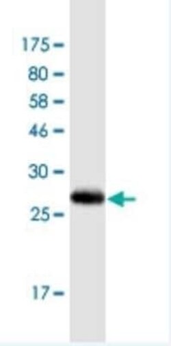 SLC37A4 Antibody (7B9), Novus Biologicals 100 &mu;g | Buy Online | Novus Biologicals | Fisher Scientific