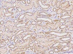 SLC38A11 Antibody, Novus Biologicals 100 &mu;g | Buy Online | Novus Biologicals | Fisher Scientific