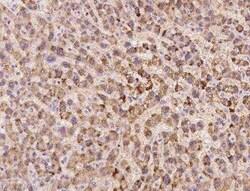 SLC38A11 Antibody, Novus Biologicals 100 &mu;g | Buy Online | Novus Biologicals | Fisher Scientific