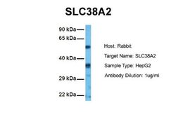 SLC38A2 Rabbit anti-Human, Polyclonal, Novus Biologicals 0.1ml; Unconjugated:Antibodies,