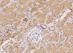 SLC38A3 Antibody, Novus Biologicals:Antibodies:Primary Antibodies