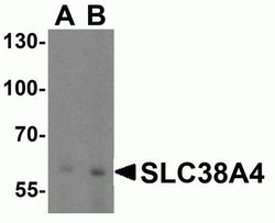 SLC38A4 Antibody - BSA Free, Novus Biologicals 0.1 mg; Unconjugated:Antibodies,