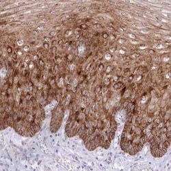 SLC39A10 Antibody, Novus Biologicals 25 &mu;L; Unconjugated:Antibodies,