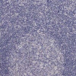 SLC39A14 Rabbit anti-Human, Polyclonal, Novus Biologicals 100 &mu;g; Unconjugated:Antibodies,