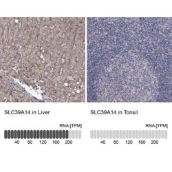 SLC39A14 Rabbit anti-Human, Polyclonal, Novus Biologicals 100 &mu;g; Unconjugated:Antibodies,