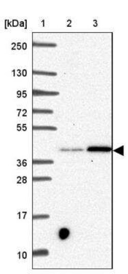 SLC39A3 Antibody, Novus Biologicals 0.1 mL, Unconjugated:Antibodies, Polyclonal