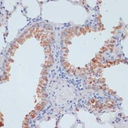 SLC39A4/ZIP4 Antibody - BSA Free, Novus Biologicals:Antibodies:Primary