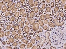 SLC39A8/ZIP8 Antibody, Novus Biologicals 50 &mu;g, Unconjugated:Antibodies,