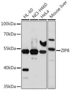 SLC39A8/ZIP8 Antibody - BSA Free, Novus Biologicals:Antibodies:Primary