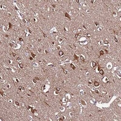 SLC41A3 Antibody, Novus Biologicals:Antibodies:Primary Antibodies