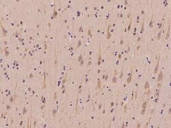 SLC41A3 Antibody, Novus Biologicals:Antibodies:Primary Antibodies