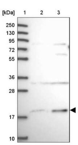 SLC41A3 Antibody, Novus Biologicals:Antibodies:Primary Antibodies