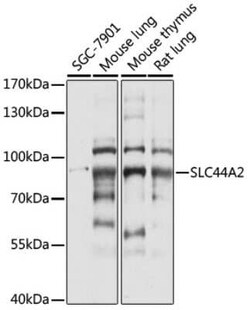 SLC44A2 Antibody - Azide and BSA Free, Novus Biologicals:Antibodies:Primary