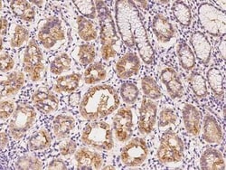 SLC44A3 Antibody, Novus Biologicals:Antibodies:Primary Antibodies