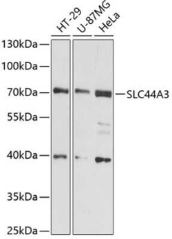 SLC44A3 Antibody - Azide and BSA Free, Novus Biologicals:Antibodies:Primary