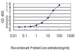 SLC45A2 Antibody (1B2), Novus Biologicals 0.1 mg | Buy Online | Novus Biologicals | Fisher Scientific