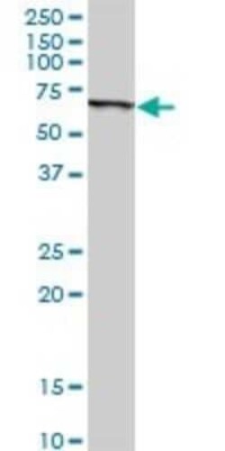 SLC45A2 Antibody, Novus Biologicals 0.1 mg | Buy Online | Novus Biologicals | Fisher Scientific