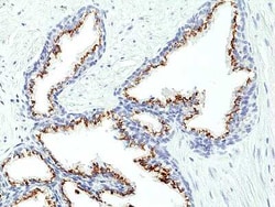 SLC45A3/Prostein Rabbit anti-Human, Clone: RM426, Novus Biologicals:Antibodies:Primary