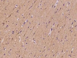 SLC4A10 Antibody, Novus Biologicals:Antibodies:Primary Antibodies