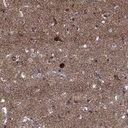 SLC4A10 Rabbit anti-Human, Polyclonal, Novus Biologicals 25 &mu;g | Buy Online | Novus Biologicals | Fisher Scientific