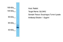 SLC4A3 Rabbit anti-Human, Polyclonal, Novus Biologicals 0.1ml; Unconjugated:Antibodies,