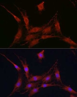 SLC4A4 Antibody - Azide and BSA Free, Novus Biologicals 0.1 mL; Unconjugated:Antibodies,