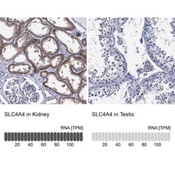 SLC4A4 Rabbit anti-Human, Polyclonal, Novus Biologicals 25 &mu;g; Unconjugated:Antibodies,