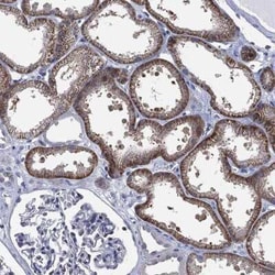 SLC4A4 Rabbit anti-Human, Polyclonal, Novus Biologicals 25 &mu;g; Unconjugated:Antibodies,