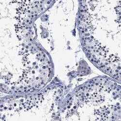 SLC4A4 Rabbit anti-Human, Polyclonal, Novus Biologicals 25 &mu;g; Unconjugated:Antibodies,