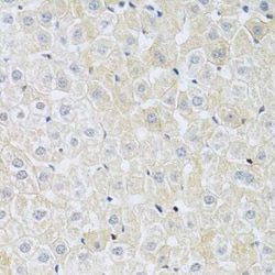 SLC4A5 Antibody - BSA Free, Novus Biologicals 0.02 mL, Unconjugated:Antibodies,