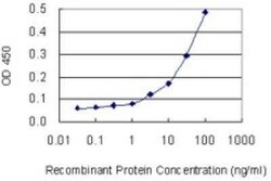 SLC4A8 Antibody (6E11), Novus Biologicals 0.1 mg | Buy Online | Novus Biologicals | Fisher Scientific