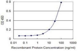 SLC6A16 Antibody (2E5), Novus Biologicals 0.1 mg | Buy Online | Novus Biologicals | Fisher Scientific