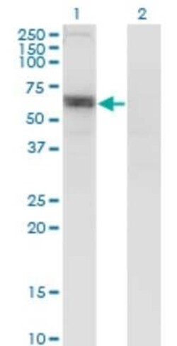 SLC6A16 Antibody (2E5), Novus Biologicals 0.1 mg | Buy Online | Novus Biologicals | Fisher Scientific