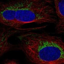 SLC6A17 Rabbit anti-Human, Polyclonal, Novus Biologicals 100 &mu;g; Unconjugated:Antibodies,