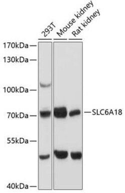 SLC6A18 Antibody - Azide and BSA Free, Novus Biologicals 0.1 mL, Unconjugated:Antibodies,