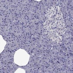 SLC6A2/NET/Noradrenaline transporter Antibody, Novus Biologicals 100 &mu;g;