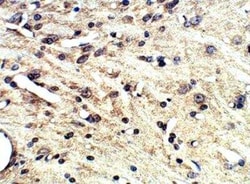 SLC6A2/NET/Noradrenaline transporter Antibody, Novus Biologicals 100 &mu;g;