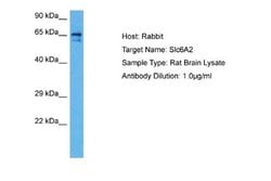 SLC6A2/NET/Noradrenaline transporter Rabbit anti-Human, Rat, Polyclonal,