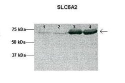SLC6A2/NET/Noradrenaline transporter Rabbit anti-Human, Rat, Polyclonal,