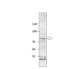 SLC6A2/NET/Noradrenaline transporter Antibody, Novus Biologicals 100 &mu;g;