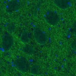 SLC6A3/DAT1 Antibody (CL3123), Novus Biologicals:Antibodies:Primary Antibodies